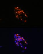 NEFM Antibody in Immunocytochemistry (ICC/IF)