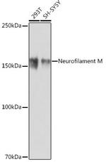 NEFM Antibody in Western Blot (WB)