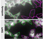 DJ-1 Recombinant Rabbit Monoclonal Antibody (1Q7F8)