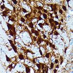 Parvalbumin Antibody in Immunohistochemistry (Paraffin) (IHC (P))