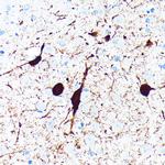 Parvalbumin Antibody in Immunohistochemistry (Paraffin) (IHC (P))