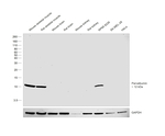 Parvalbumin Antibody in Western Blot (WB)