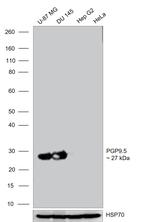PGP9.5 Antibody in Western Blot (WB)
