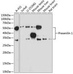 Presenilin 1 Recombinant Rabbit Monoclonal Antibody (3W4V8)