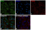 S100A4 Recombinant Rabbit Monoclonal Antibody (8R2W0)