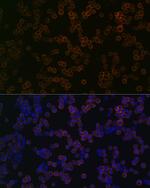 TLR2 Recombinant Rabbit Monoclonal Antibody (8Q6M9)