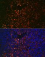VCAM-1 (CD106) Antibody in Immunohistochemistry (Paraffin) (IHC (P))