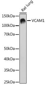 VCAM-1 (CD106) Antibody in Western Blot (WB)