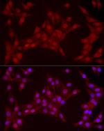 YAP1 Recombinant Rabbit Monoclonal Antibody (10G4S10)