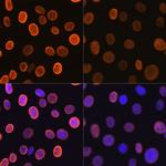 H4K5ac Recombinant Rabbit Monoclonal Antibody (10G1L0)