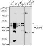 C/EBP beta Recombinant Rabbit Monoclonal Antibody (9W4A10)