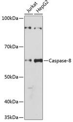 Caspase 8 Recombinant Rabbit Monoclonal Antibody (7R6N8)
