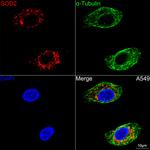 SOD2 Recombinant Rabbit Monoclonal Antibody (9T2Z1)