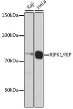 RIP1 Recombinant Rabbit Monoclonal Antibody (2V4N8)