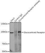 Glucocorticoid Receptor Antibody in Immunoprecipitation (IP)