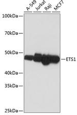 ETS1 Recombinant Rabbit Monoclonal Antibody (5P4K1)