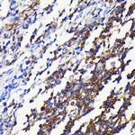 NFkB p52/p100 Recombinant Rabbit Monoclonal Antibody (4K3V3)