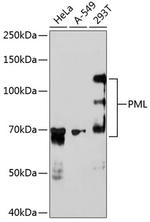 PML Recombinant Rabbit Monoclonal Antibody (2A0N10)