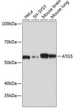 ATG5 Antibody in Western Blot (WB)