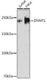 DNMT1 Recombinant Rabbit Monoclonal Antibody (1K5K8)