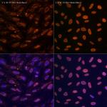 N6-Methyladenosine (m6A) Recombinant Rabbit Monoclonal Antibody (6S5W2)