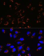 PRDX3 Recombinant Rabbit Monoclonal Antibody (4K7D1)