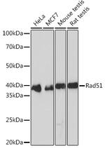 RAD51 Recombinant Rabbit Monoclonal Antibody (5S9B0)