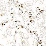 TFAM Antibody in Immunohistochemistry (Paraffin) (IHC (P))