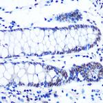 NRF1 Recombinant Rabbit Monoclonal Antibody (4Q4E7)