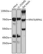 RPA70 Recombinant Rabbit Monoclonal Antibody (5R7S3)
