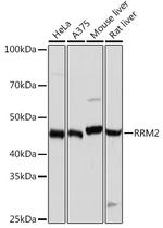 RRM2 Recombinant Rabbit Monoclonal Antibody (10Y6E4)