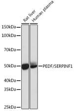 PEDF Recombinant Rabbit Monoclonal Antibody (4H0C5)