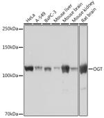 OGT Recombinant Rabbit Monoclonal Antibody (3Q9B8)