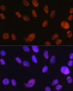 SMARCA5 Antibody in Immunocytochemistry (ICC/IF)