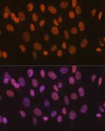 SMARCA5 Antibody in Immunocytochemistry (ICC/IF)