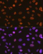 SMARCA5 Antibody in Immunocytochemistry (ICC/IF)
