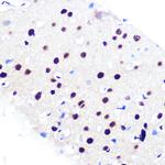 RbAp48 Antibody in Immunohistochemistry (Paraffin) (IHC (P))