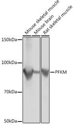 PFKM Recombinant Rabbit Monoclonal Antibody (4Z7X1)
