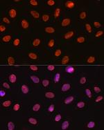 SNRPA Antibody in Immunocytochemistry (ICC/IF)