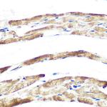 FBXO32 Recombinant Rabbit Monoclonal Antibody (1F10Z5)