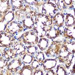 NCF2 Recombinant Rabbit Monoclonal Antibody (7J7N3)