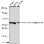 P2Y6 Recombinant Rabbit Monoclonal Antibody (4I8C9)