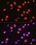 BAF57 Recombinant Rabbit Monoclonal Antibody (9L5F6)
