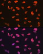 BAF57 Antibody in Immunocytochemistry (ICC/IF)