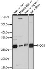 NQO2 Recombinant Rabbit Monoclonal Antibody (5E0B2)