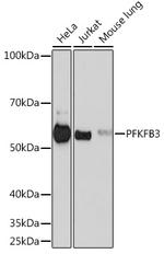 PFKFB3 Recombinant Rabbit Monoclonal Antibody (7X10D9)
