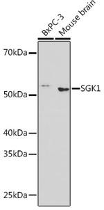 SGK1 Recombinant Rabbit Monoclonal Antibody (3P4N3)