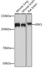 ERK5 Recombinant Rabbit Monoclonal Antibody (5C1P5)