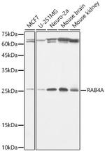 Rab4 Recombinant Rabbit Monoclonal Antibody (8I5K1)