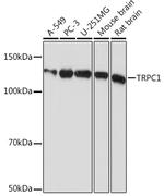 TRPC1 Recombinant Rabbit Monoclonal Antibody (1V3Q2)